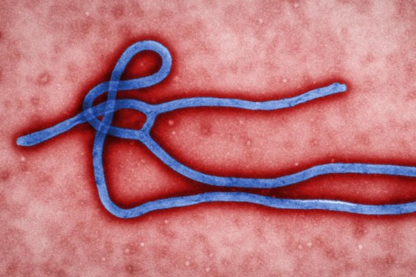 Ebola