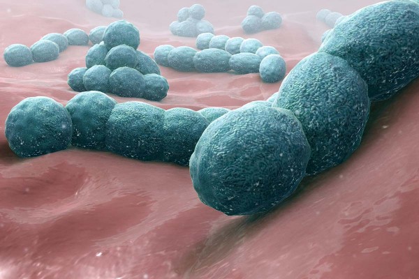 Meningococcal Meningitis